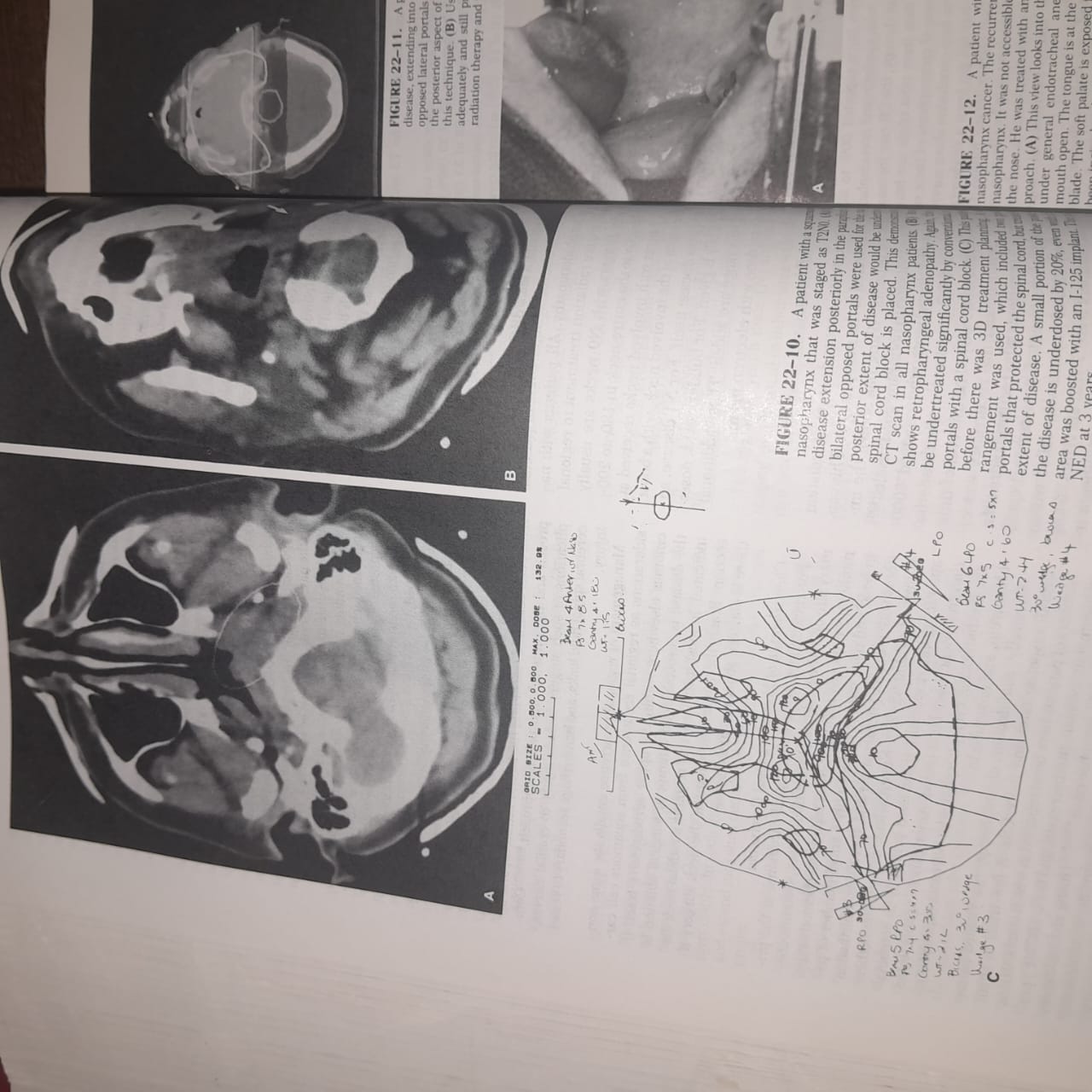 موسوعة Cancer: Principles & Practice of Oncology – الإصدار الرابع (جزآن كاملان)
